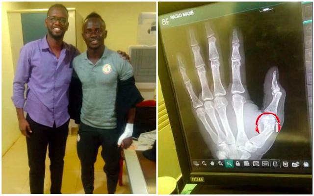 Sadio Mane Hand