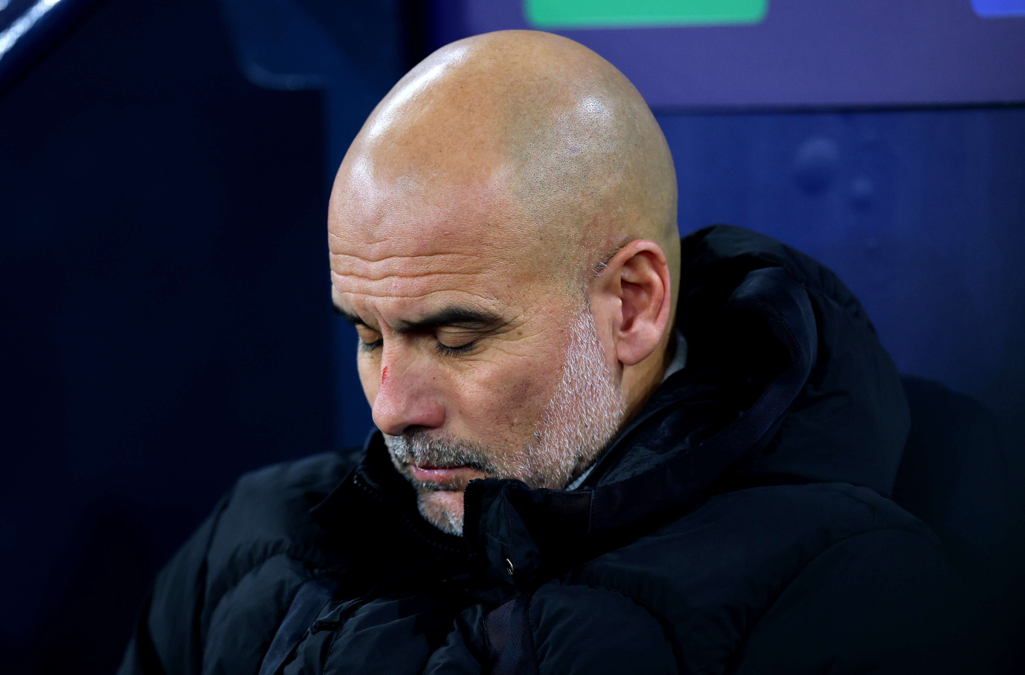 Pep Guardiola looks dismayed during Manchester City v Feyenoord.