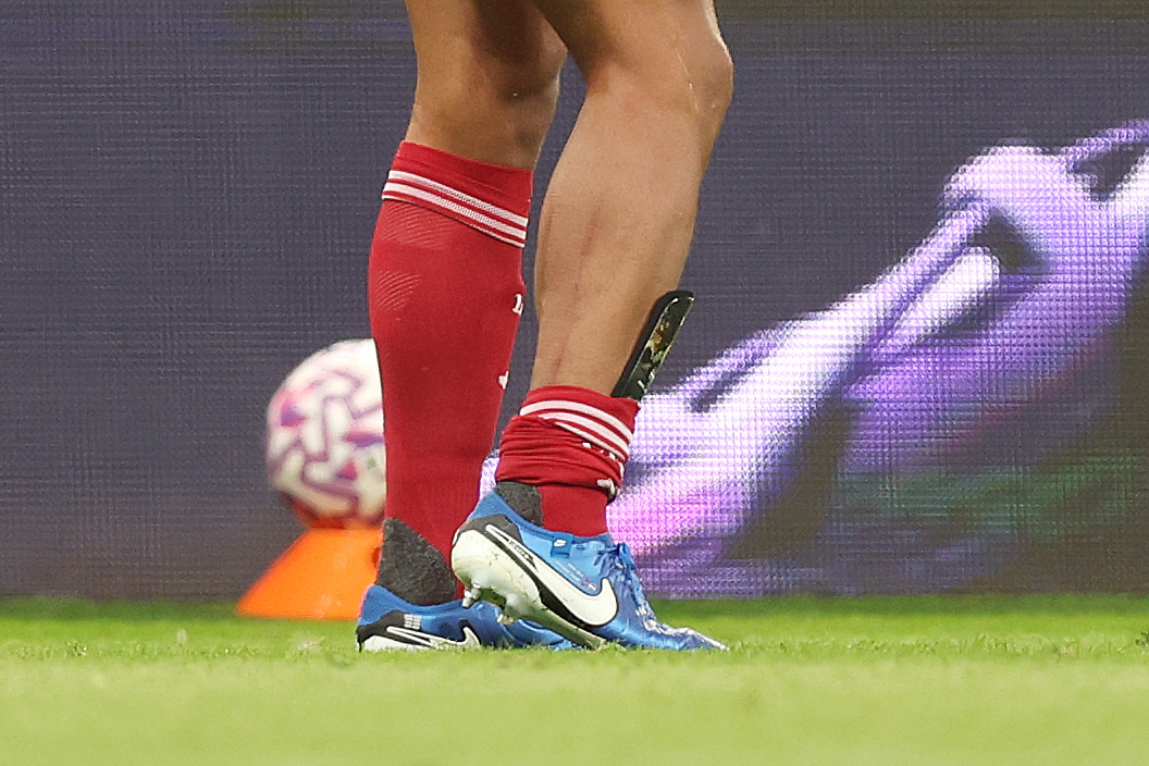 Virgil van Dijk was left with stud marks on his calf after Anthony Gordon's tackle on him on Monday night